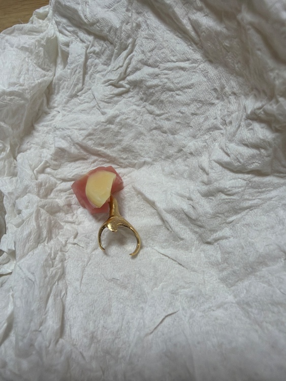 入れ歯（金・貴金属）の商品画像 - 査定依頼日：2026年1月27日 - 最高査定価格：5,000円