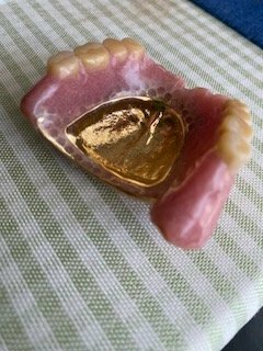 総入れ歯（金・貴金属）の商品画像 - 査定依頼日：2026年5月11日 - 最高査定価格：200,000円