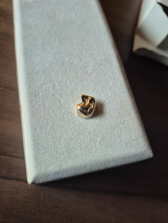 18金一粒真珠ネックレス　18金指輪　金歯（金・貴金属）の商品画像 - 査定依頼日：2025年11月20日 - 最高査定価格：88,000円