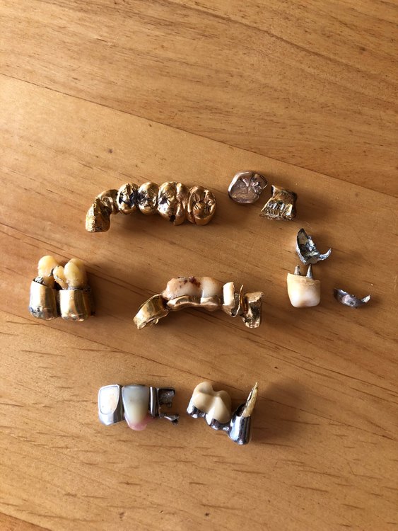 金歯　銀歯（金・貴金属）の商品画像 - 査定依頼日：2023年5月23日 - 最高査定価格：277,450円