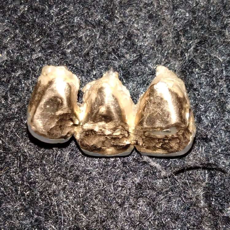 金歯（金・貴金属）の商品画像 - 査定依頼日：2023年8月5日 - 最高査定価格：50,000円