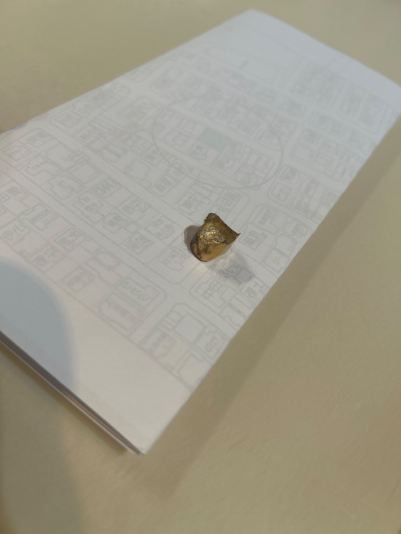 金歯（金・貴金属）の商品画像 - 査定依頼日：2026年8月16日 - 最高査定価格：30,000円