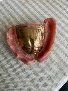 総入れ歯（金・貴金属）の商品画像 - 査定依頼日：2026年5月11日 - 最高査定価格：200,000円