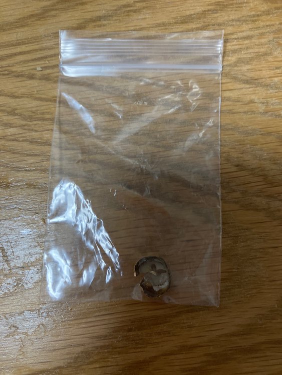 金歯（金・貴金属）の商品画像 - 査定依頼日：2023年3月15日 - 最高査定価格：5,000円