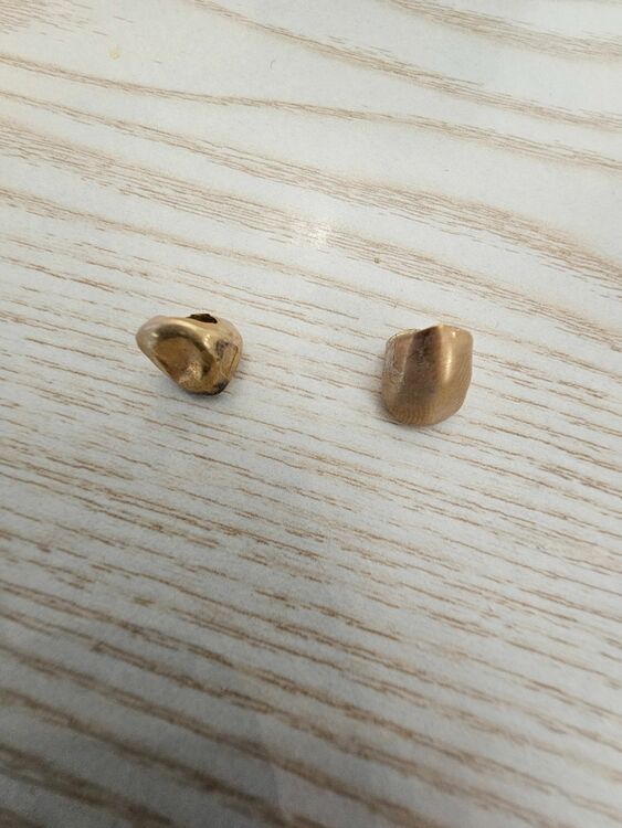 リング　金歯（金・貴金属）の商品画像 - 査定依頼日：2025年6月17日 - 最高査定価格：100,000円