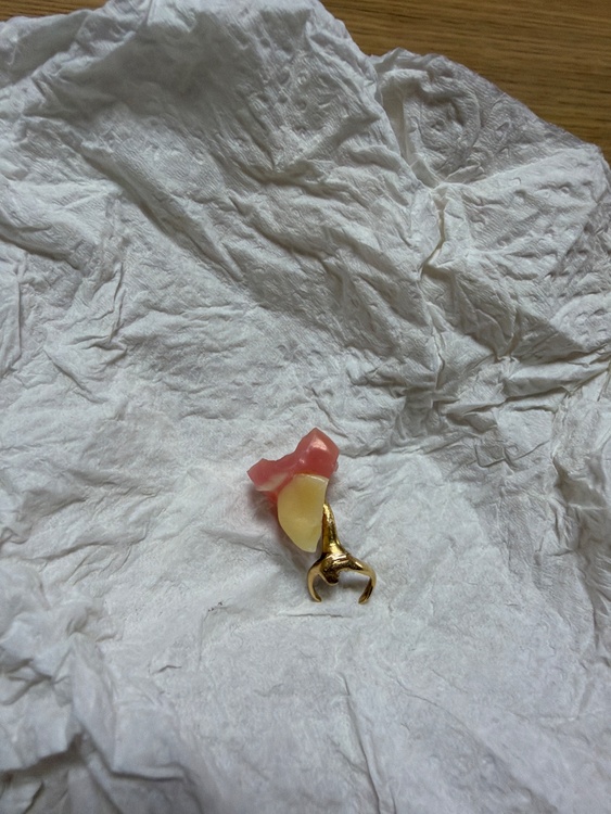 入れ歯（金・貴金属）の商品画像 - 査定依頼日：2026年1月27日 - 最高査定価格：5,000円