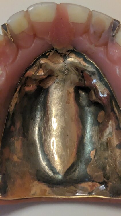 金属床義歯（金・貴金属）の商品画像 - 査定依頼日：2026年2月25日 - 最高査定価格：100,000円