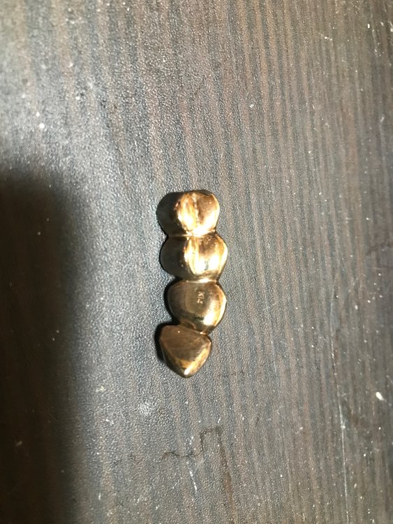 金歯14K（金・貴金属）の商品画像 - 査定依頼日：2023年9月10日 - 最高査定価格：10,000円