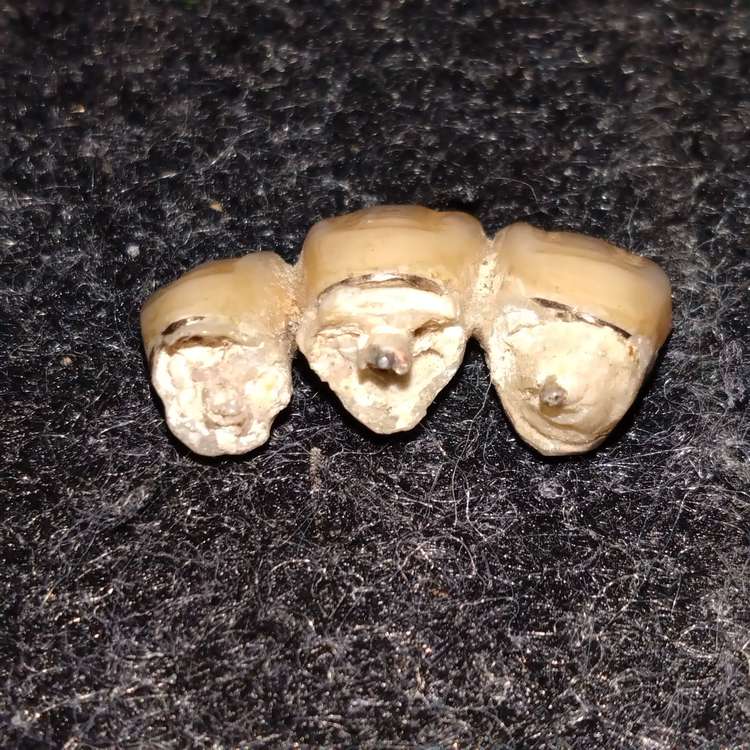 金歯（金・貴金属）の商品画像 - 査定依頼日：2023年8月5日 - 最高査定価格：50,000円