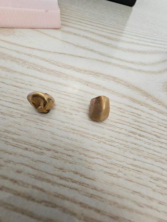 リング　金歯（金・貴金属）の商品画像 - 査定依頼日：2025年6月17日 - 最高査定価格：100,000円