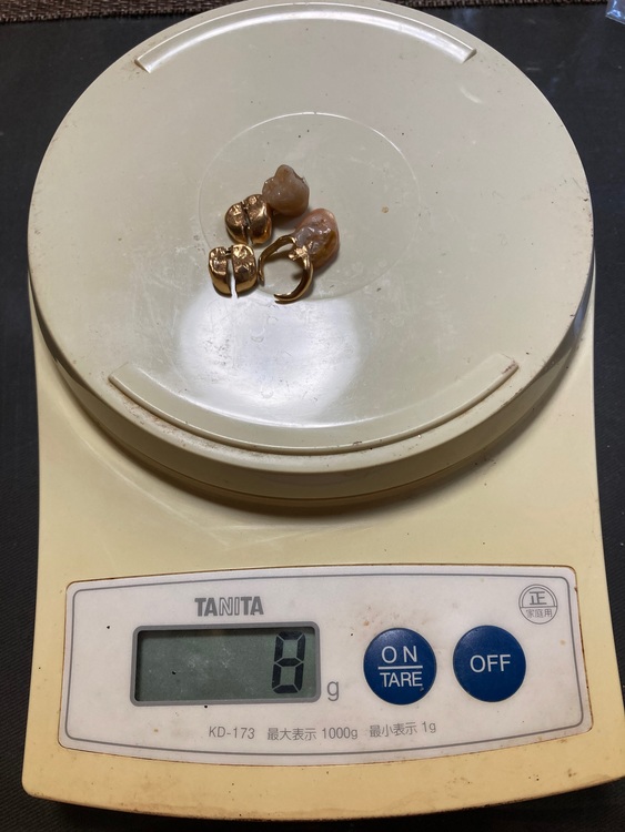 金歯（金・貴金属）の商品画像 - 査定依頼日：2022年7月2日 - 最高査定価格：64,896円