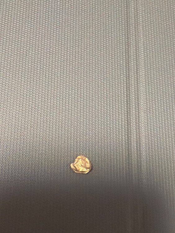 インゴット 1g + 金歯 約2g（金・貴金属）の商品画像 - 査定依頼日：2026年1月4日 - 最高査定価格：32,000円